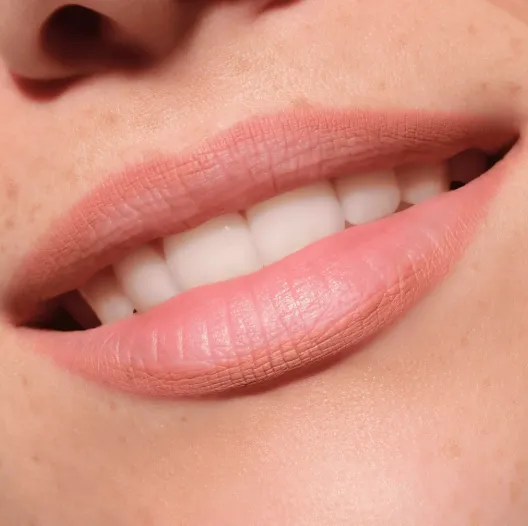 Capture d'écran 2026-03-13 152431.webp